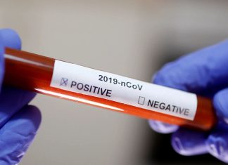 Covid-19: por que o Brasil não realiza testes em massa?