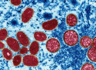 Varíola dos macacos: Uma emergência internacional